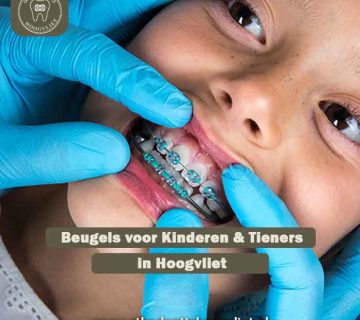 Orthodontie voor kinderen Hoogvliet - Beugel voor overbeet correctie