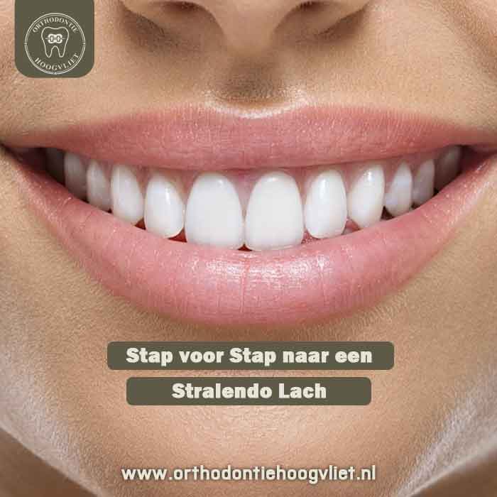 Stralende lach na een orthodontische behandeling stappen Hoogvliet bij Orthodontie Hoogvliet.
