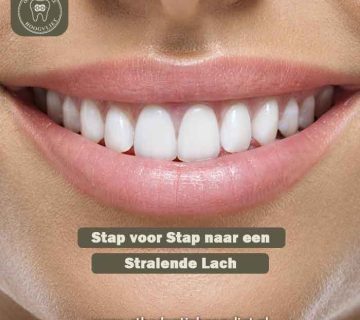 Stralende lach na een orthodontische behandeling stappen Hoogvliet bij Orthodontie Hoogvliet.