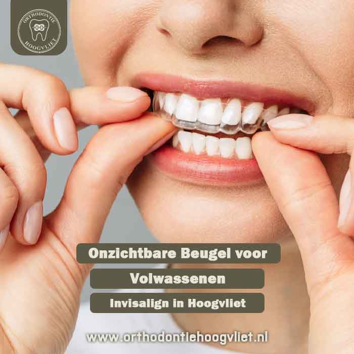Vrouw die een onzichtbare beugel (Invisalign) draagt bij Orthodontie Hoogvliet voor volwassenen