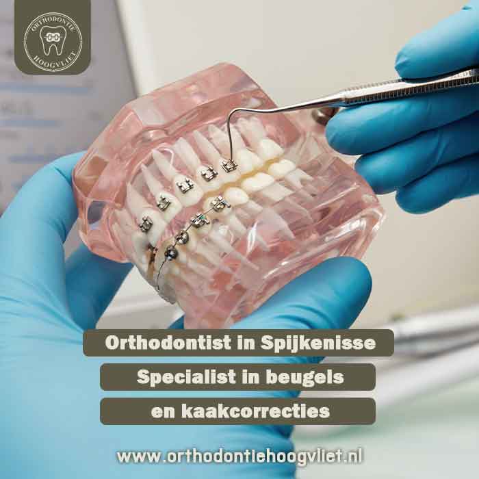 Orthodontist in Spijkenisse – Specialist in beugels en kaakcorrecties