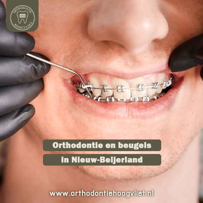 Orthodontie en beugels in Nieuw‑Beijerland – Moderne zorg dichtbij