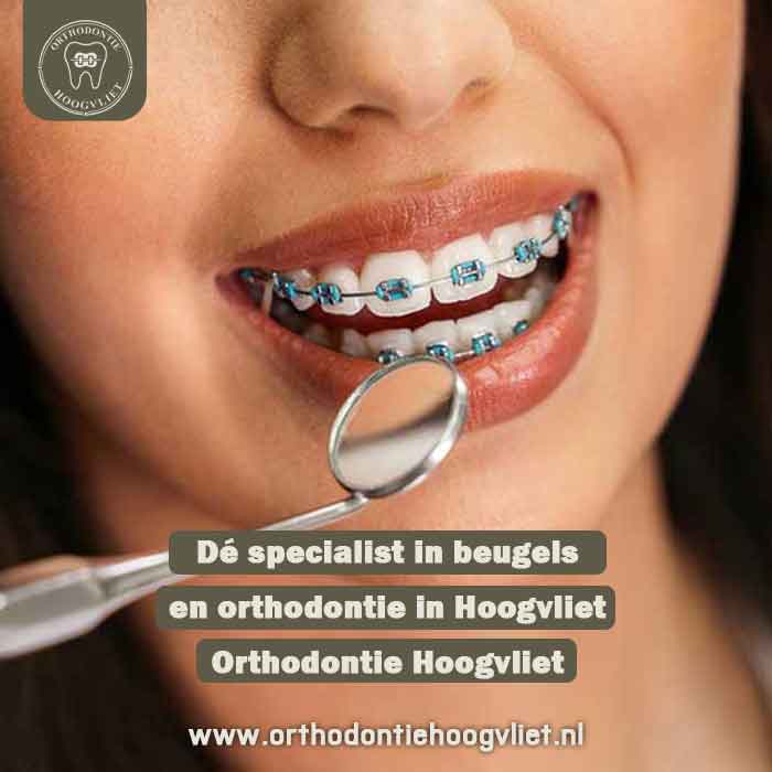 Dé specialist in beugels en orthodontie in Hoogvliet – Orthodontie Hoogvliet