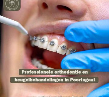 Professionele orthodontie en beugelbehandelingen in Poortugaal