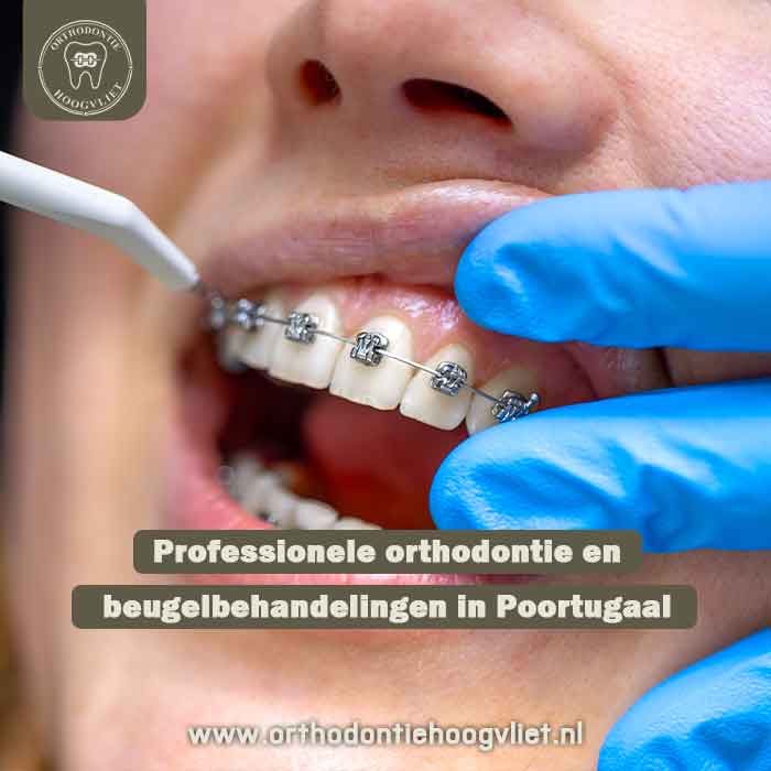 Professionele orthodontie en beugelbehandelingen in Poortugaal