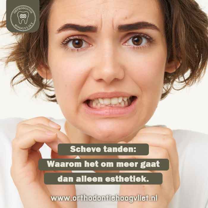 Een bezorgde vrouw die haar tanden laat zien met de tekst: Scheve tanden: Waarom het om meer gaat dan alleen esthetiek. bij Orthodontie Hoogvliet.