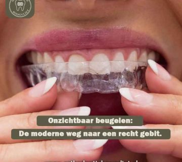 Vrouw plaatst een onzichtbare beugel in haar mond - Orthodontie Hoogvliet