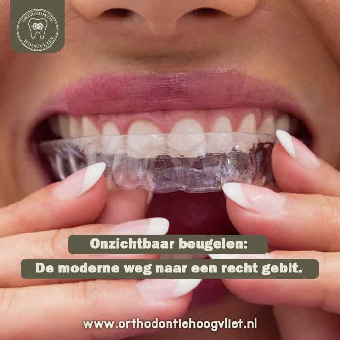 Vrouw plaatst een onzichtbare beugel in haar mond - Orthodontie Hoogvliet
