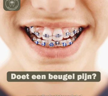 Persoon met een vaste beugel glimlacht met de tekst: Doet een beugel pijn?