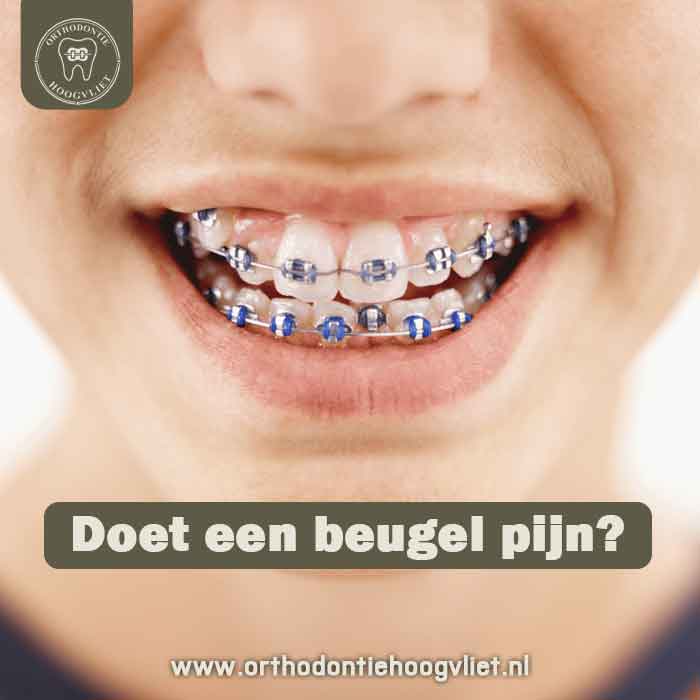 Persoon met een vaste beugel glimlacht met de tekst: Doet een beugel pijn?