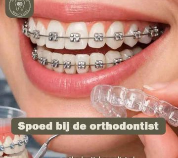Spoed orthodontist Hoogvliet - vrouw met beugel en aligner bij spoedgeval met kapotte beugel