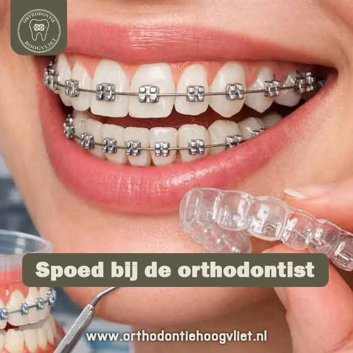 Spoed orthodontist Hoogvliet - vrouw met beugel en aligner bij spoedgeval met kapotte beugel