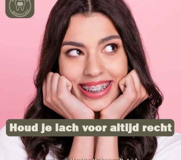 Retentiebeugel Hoogvliet - Houd je lach voor altijd recht