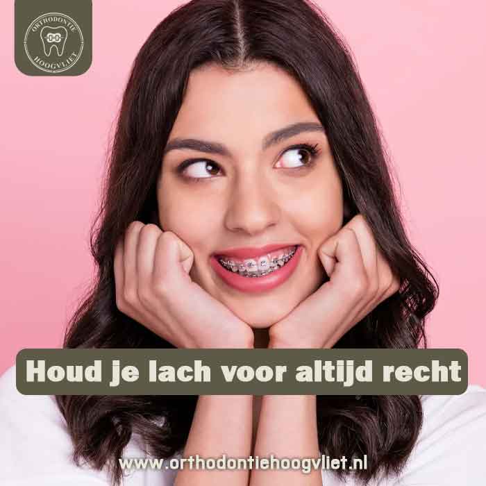 Retentiebeugel Hoogvliet - Houd je lach voor altijd recht